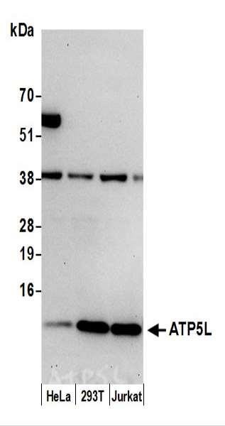 Anti-ATP5L