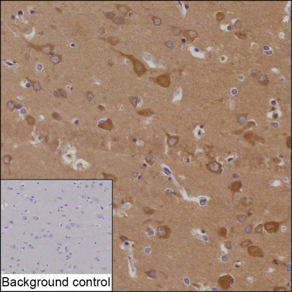 Anti-STMN4