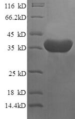 Islet cell autoantigen 1 (ICA1), partial, human, recombinant