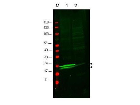 Anti-RLC of Smooth and muscle myosin (Rabbit)