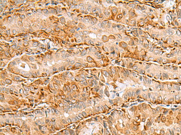 Anti-C3orf38
