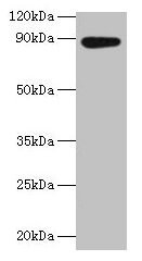 Anti-AFG3L2