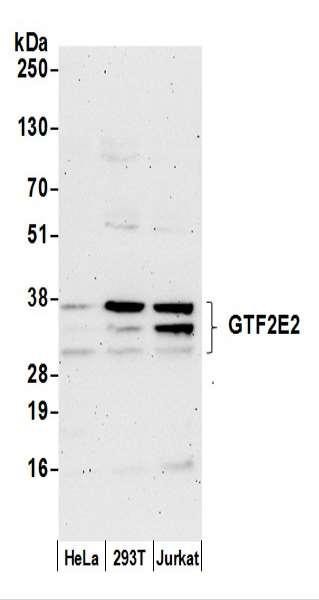 Anti-GTF2E2/TF2E2/TFIIE-beta