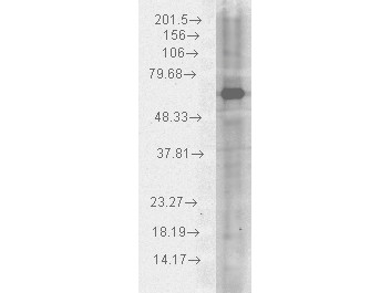 Anti-Hsp70