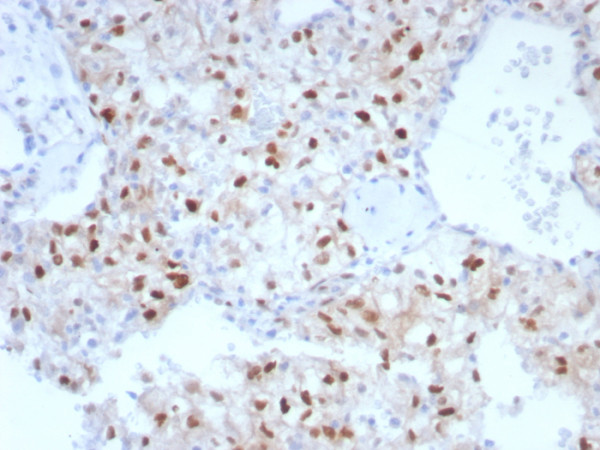 Anti-Cyclin D1 (G1-Cyclin &amp; Mantle Cell Lymphoma Marker), clone CCND1/7868
