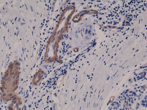 Anti-CD146 (human), Rabbit Monoclonal (RM249)