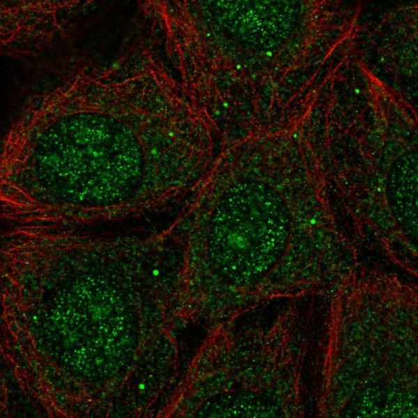 Anti-PACSIN1