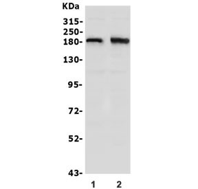 Anti-hSET1 / SET1 / SETD1A