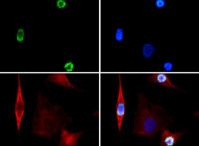 Anti-phospho-Histone H3 (p Ser28)