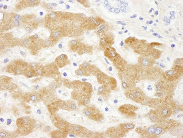 Anti-Human C-Reactive Protein (CRP) (IHC)