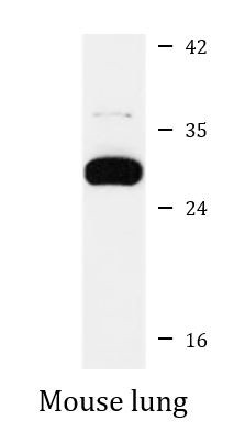 Anti-CD263 / TRAIL-R3