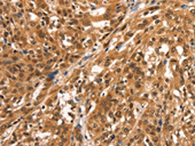 Anti-CCNE2