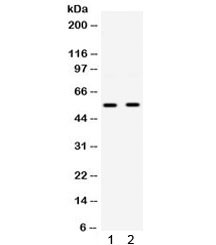 Anti-GLUT9 / Glucose Transporter 9