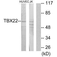 Anti-TBX22