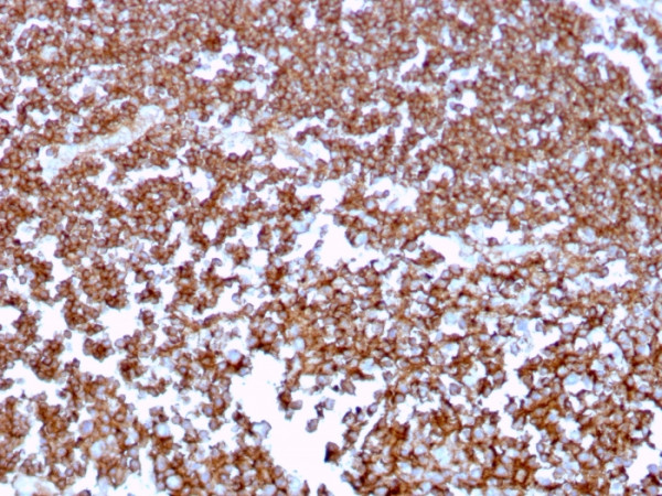 Anti-CD20 / MS4A1 (B-Cell Marker), clone MS4A1/3409