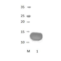 DLG1_3 PDZ Domain