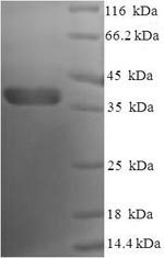 Bcl-2-like protein 1 (BCL2L1), partial, human, recombinant