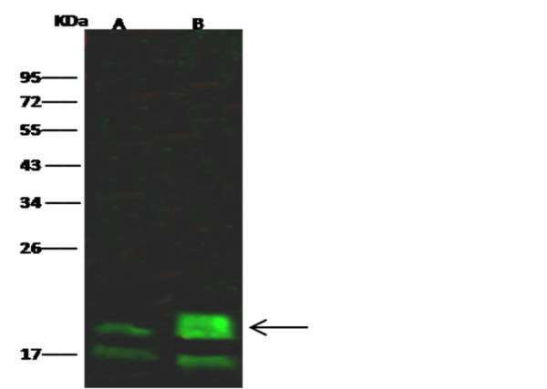 Anti-4E-BP1/EIF4EBP1 Monoclonal Antibody