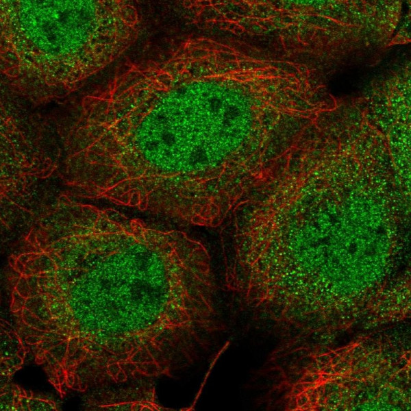 Anti-PIK3C2B