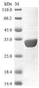 Membrane-associated phosphatidylinositol transfer protein 3 (PITPNM3), partial, human, recombinant