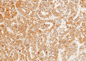 Anti-SerpinD1 Monoclonal Recombinant Antibody
