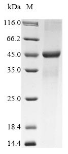 E3 ubiquitin-protein ligase TRIM63 (Trim63), rat, recombinant