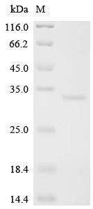 Lymphocyte antigen 6 complex locus protein G6f (LY6G6F), partial, recombinant human