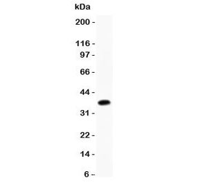 Anti-CD23