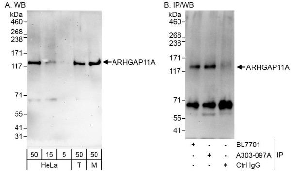 Anti-ARHGAP11A