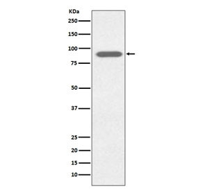 Anti-Lactoferrin / LTF, clone ABOI-12