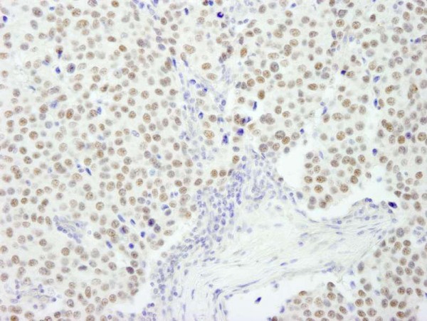 Anti-RCOR3 (IHC)