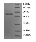 Glycosyltransferase 8 domain-containing protein 2 (GLT8D2), human, recombinant