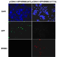 Anti-ErbB2 (V777A), monoclonal