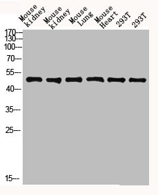 Anti-FCGR1A