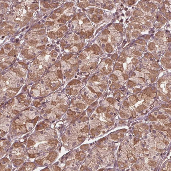 Anti-CDKL4