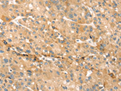 Anti-EVA1A