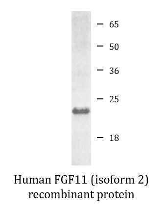Human FGF11 (isoform 2) recombinant protein (Active)