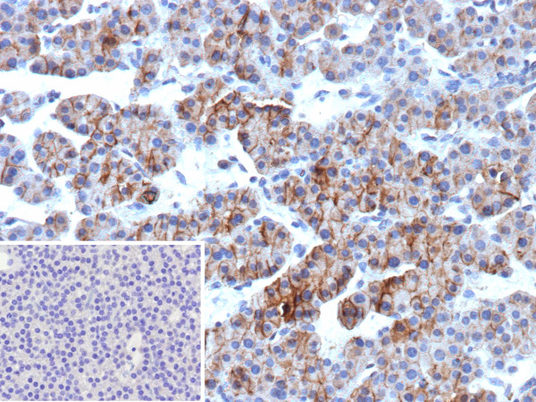 Anti-ALCAM (Activated Leukocyte Cell Adhesion Molecule) / CD166, recombinant antibody, clone rALCAM/