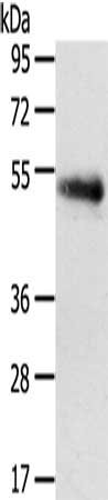 Anti-SLC7A5