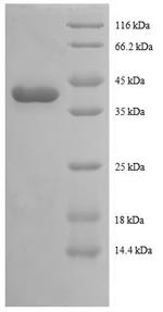 Tax1-binding protein 3 (TAX1BP3), human, recombinant