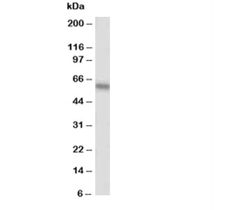 Anti-Alkaline Phosphatase