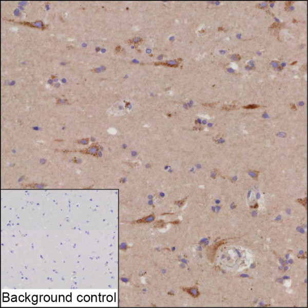 Anti-PARP6