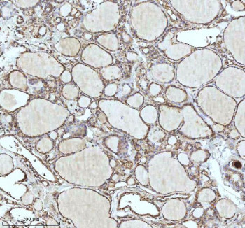 Anti-IDH3B / Isocitric dehydrogenase subunit beta