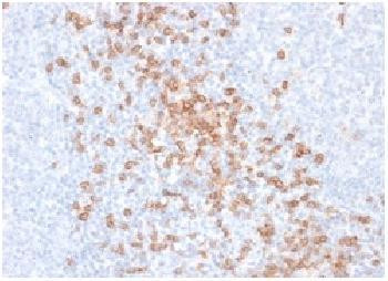 Anti-CD8A (Cytotoxic-&amp;Suppressor T-Cell Marker) Recombinant Mouse Monoclonal Antibody (clone:rC8/468