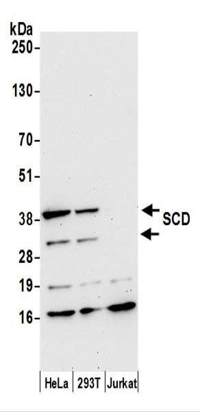 Anti-SCD/SCD1/Stearoyl-CoA Desaturase