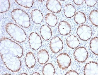 Anti-SATB2, clone SATB2/7111