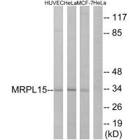 Anti-MRPL15