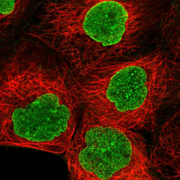 Anti-AMPD3