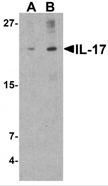 Anti-IL-17A