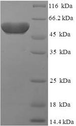 Protein atonal homolog 1 (ATOH1), human, recombinant